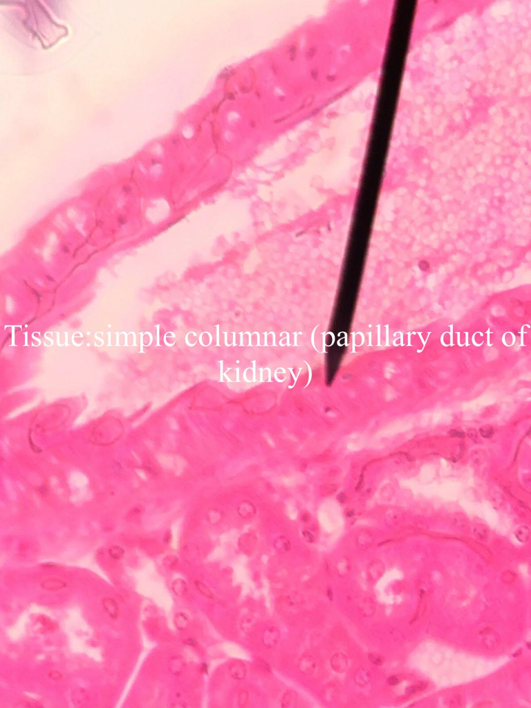 Solved Tissue:simple columnar (papillary duct of kidney | Chegg.com