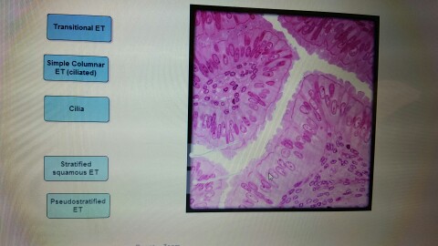 Solved Simple Columnar Cilia Stratified Pseudostratified ET | Chegg.com