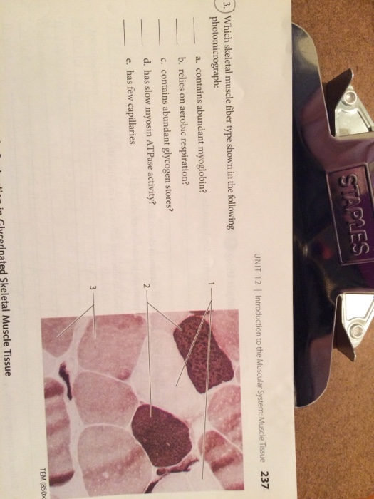 Solved Which skeletal muscle fiber type shown in the | Chegg.com