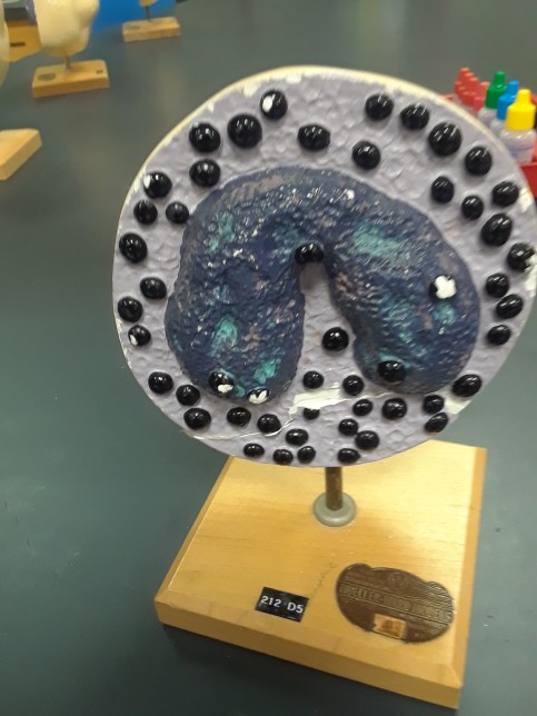 White Blood Cell Model Project