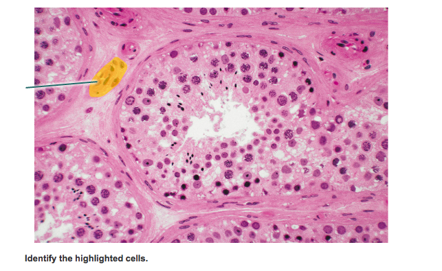 solved-identify-the-highlighted-cells-chegg