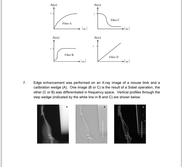 Edge enhancement was performed on an Xray image of a