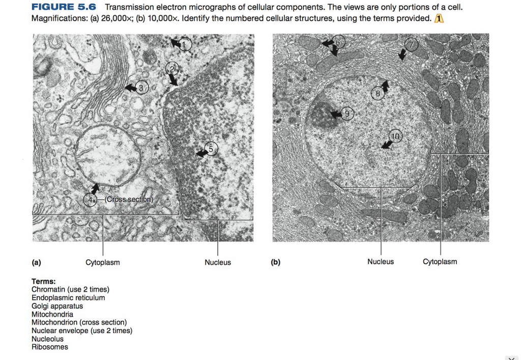 Ribosome Micrograph