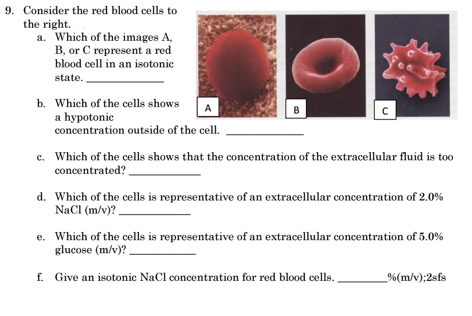 solved-consider-the-red-blood-cells-to-the-right-which-of-chegg