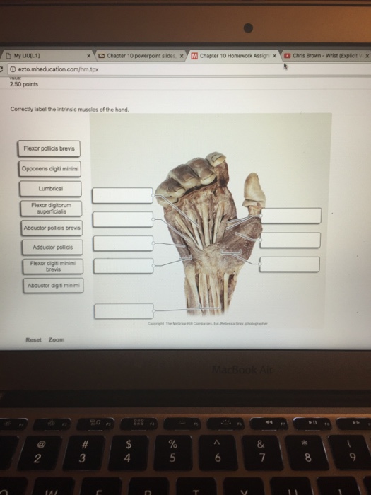 Solved Correctly label intrinsic muscles of the hand. | Chegg.com