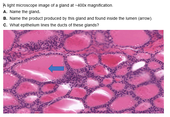 Solved A light microscope image of a gland at ~400x | Chegg.com