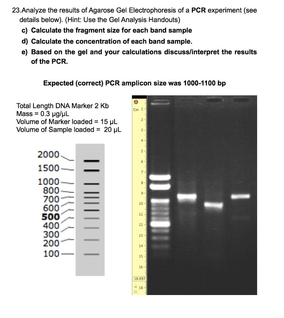 Electrophoresis Results