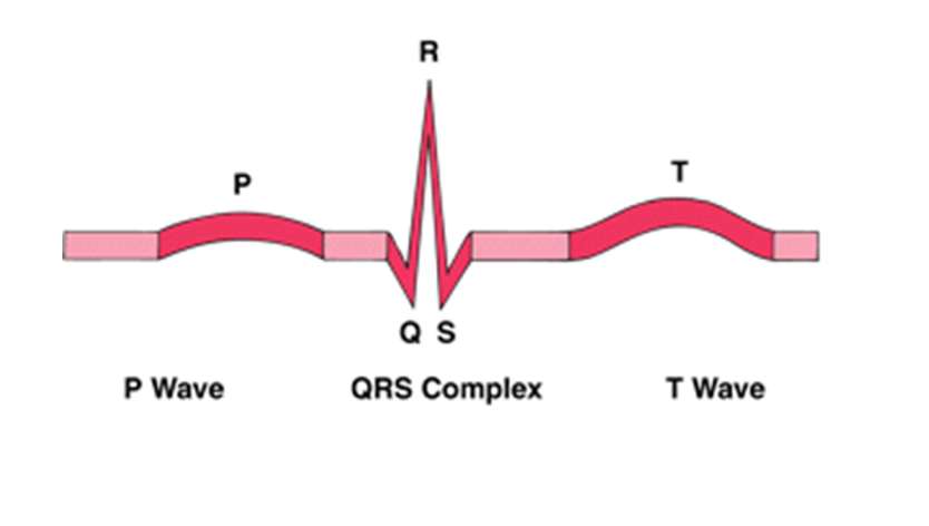 Ekg Diagram Labeled