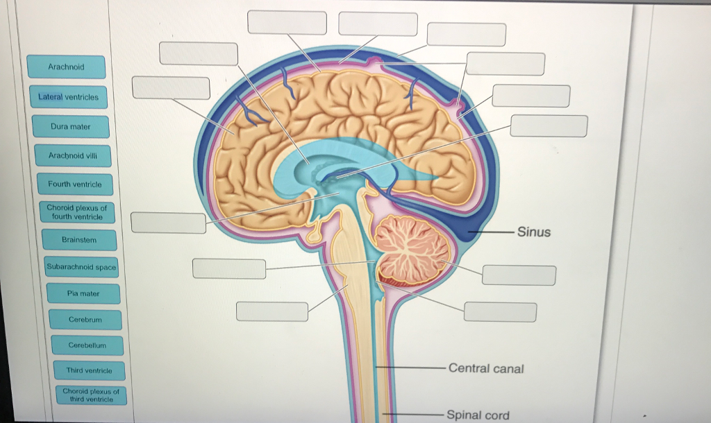 Solved Arachnoid Lateral ventricles Dura mater Arachnoid vi | Chegg.com