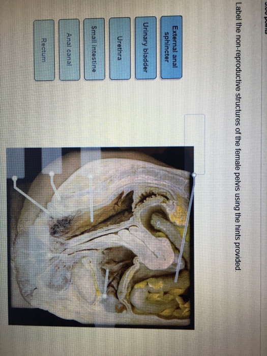 Solved Label the non-reproductive structures of the female | Chegg.com