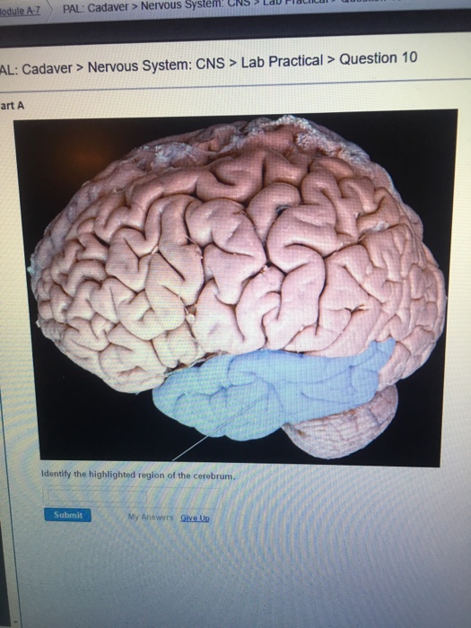 Solved AL AT PAL Cadaver Nervous System. CNS LaU Hl Ullul