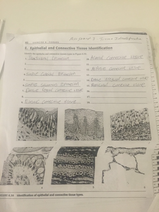 Solved E. Epithelial and Connective Tissue Identification | Chegg.com