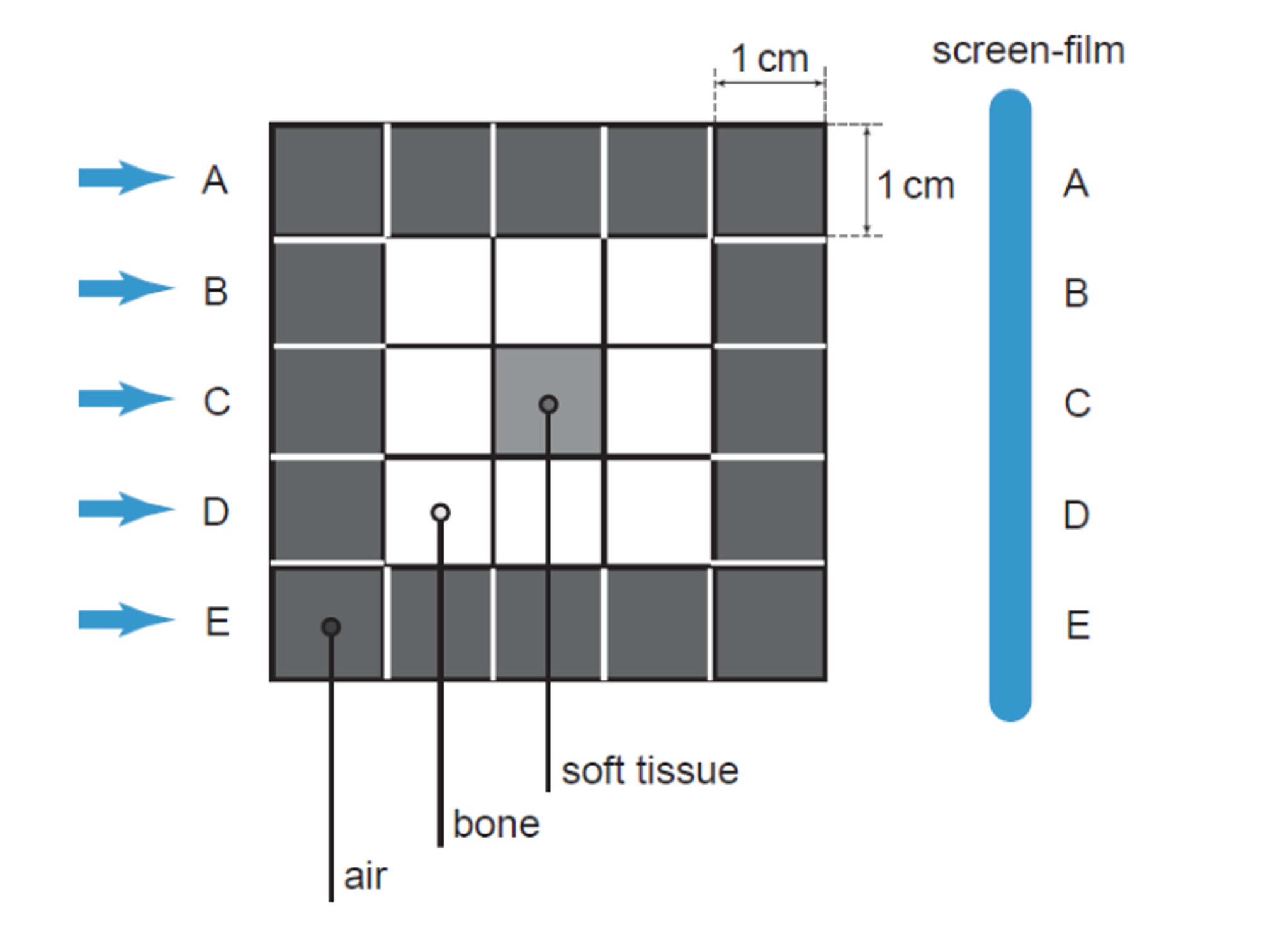 Picture Frame Pattern Radiography Solved A radiograph of a structure consisting of bone and | Chegg.com