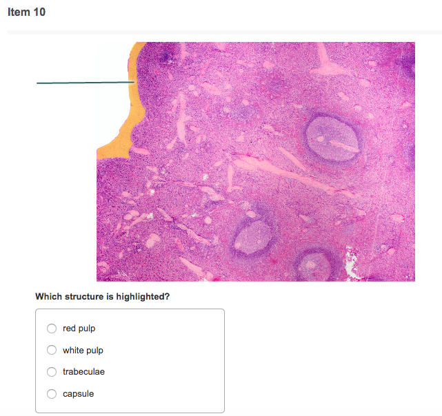 Solved ltem 10 Which structure is highlighted? O red pulp