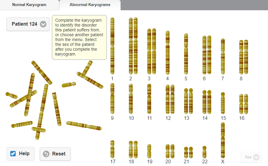 Solved Normal Karyogram Abnormal Karyograms Drag the | Chegg.com