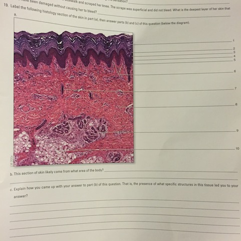 Solved Label the following histology section of the skin in | Chegg.com