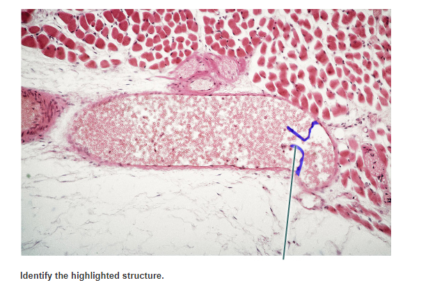 Solved Identify The Highlighted Vessel. | Chegg.com