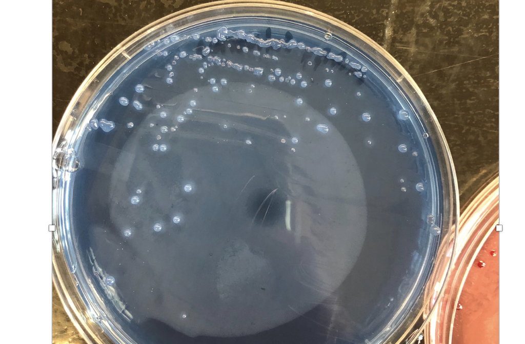 solved-how-to-determine-which-bacteria-was-growing-on-this-chegg