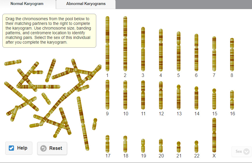 Solved Normal Karyogram Abnormal Karyograms Drag the | Chegg.com