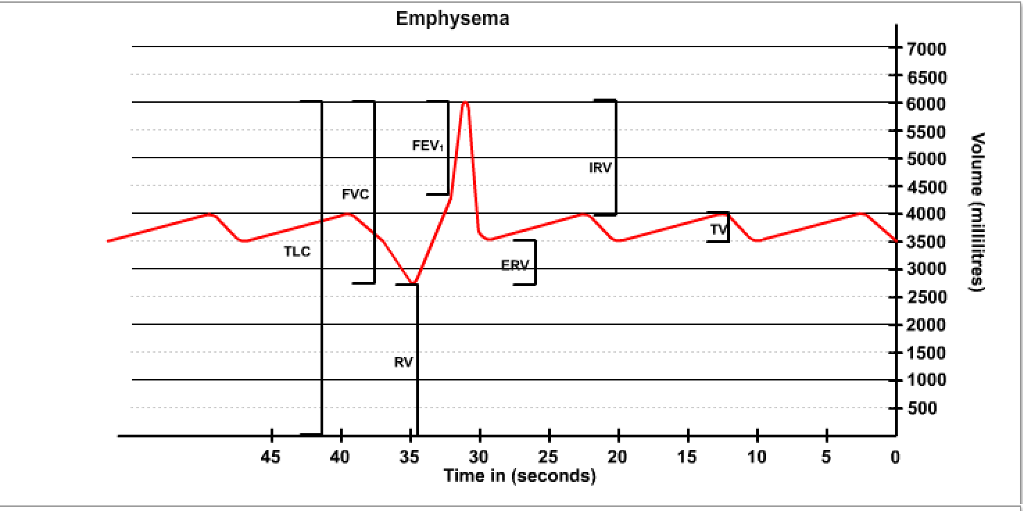 Solved Lab Report Experiment Data Patient Type Heavy