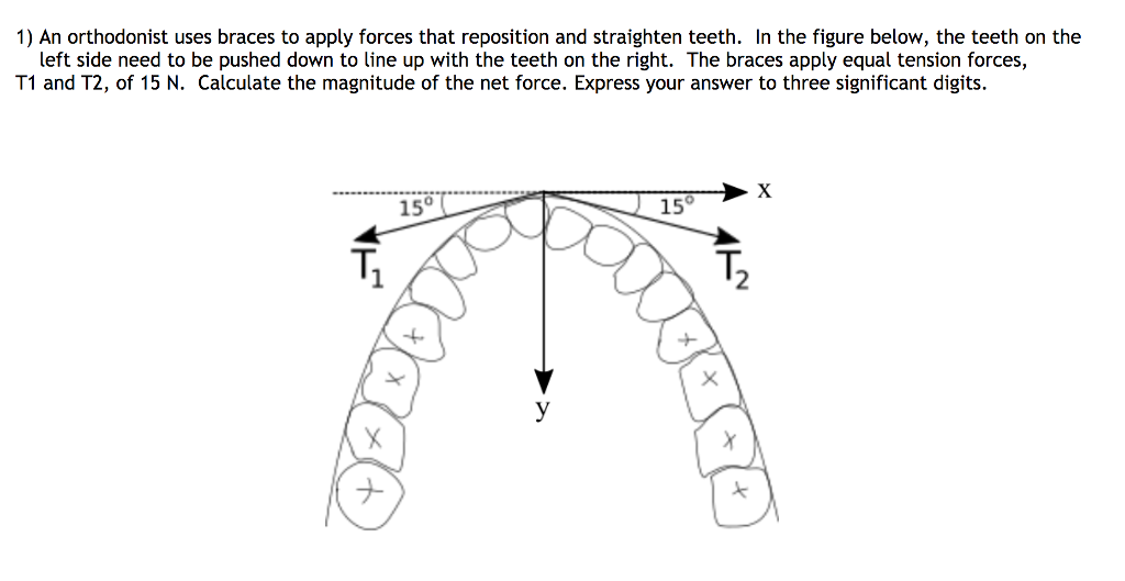 Solved 1) An orthodonist uses braces to apply forces that