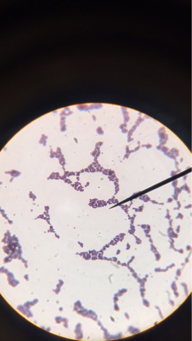 Solved In microbiology, I received an unknown bacteria of | Chegg.com