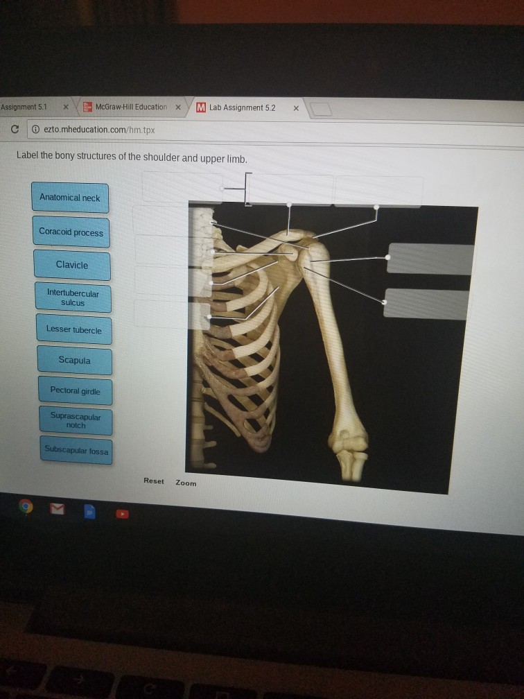 Label The Bony Structures Of The Shoulder And Uppe... | Chegg.com