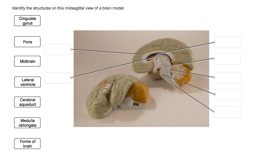 Solved Identify The Structures On This Midsagittal View Of A Chegg Com