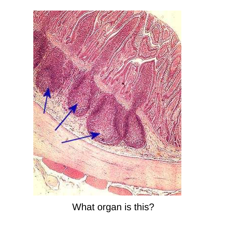 Solved What organ is this? | Chegg.com