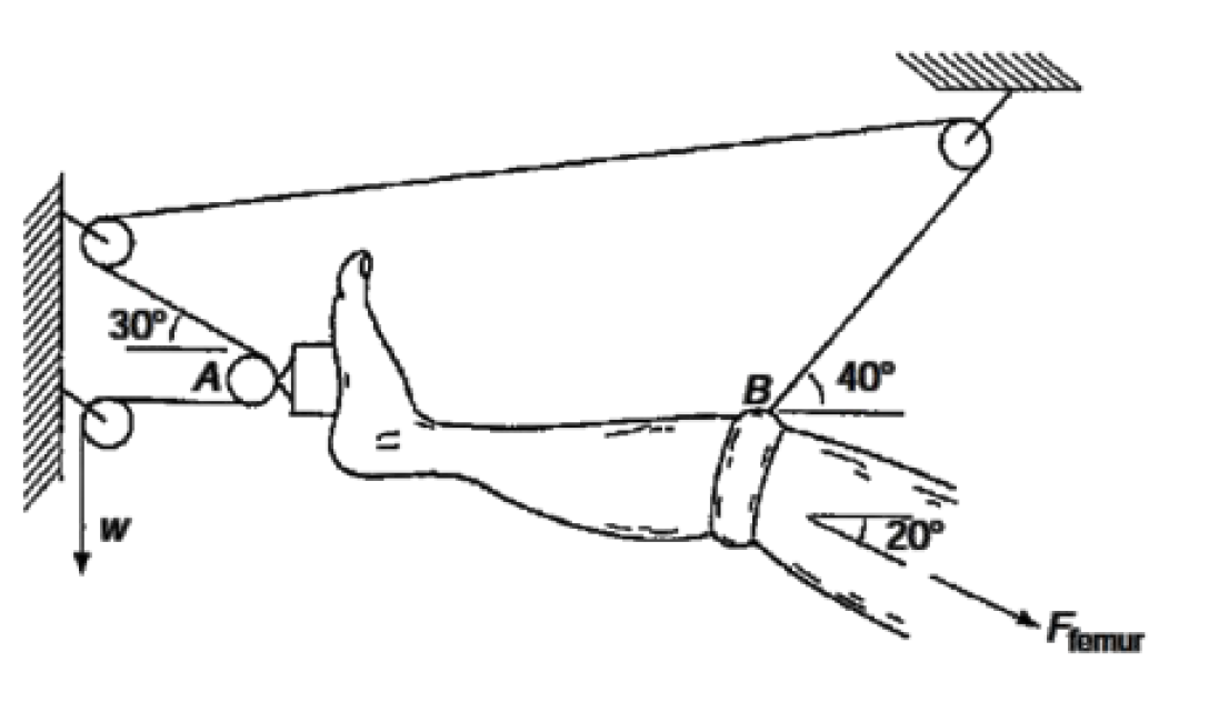 Solved Figure shows a Russell’s traction rig used to apply