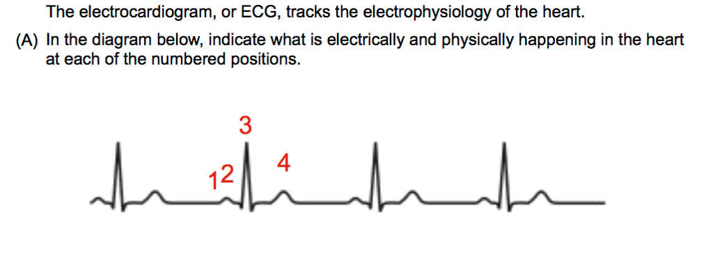 Solved The Electrocardiogram, Or ECG, Tracks The | Chegg.com