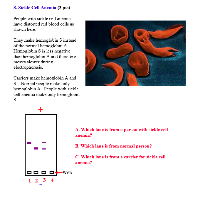 Solved 8. Sickle Cell Anemia (3 pts) People with sickle cell