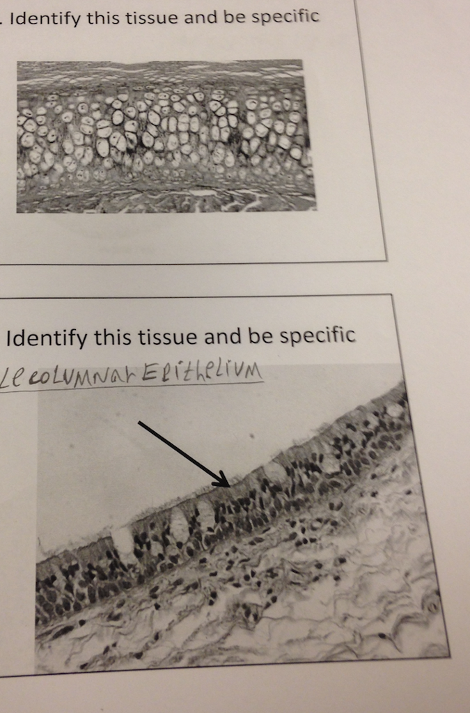 Solved Identify This Tissue And Be Specific Identify This 