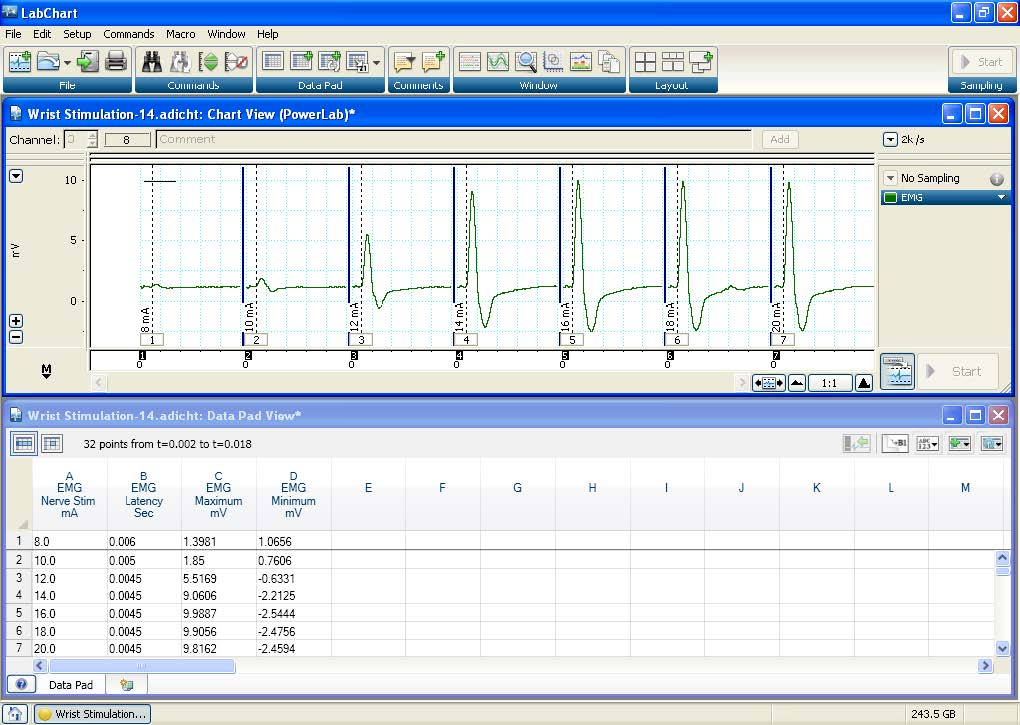 11?? LabChart File Edit Setup Commands Macro Window