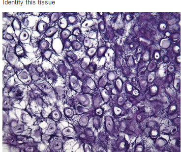 Solved Identify this tissue | Chegg.com