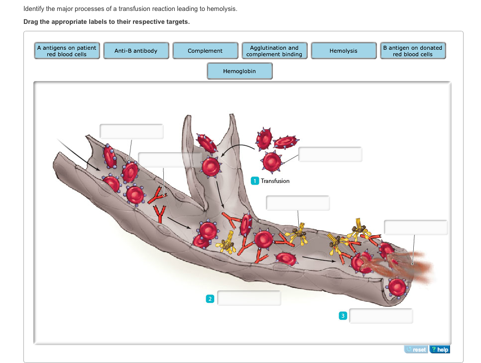 solved-identify-the-major-processes-of-a-transfusion-chegg