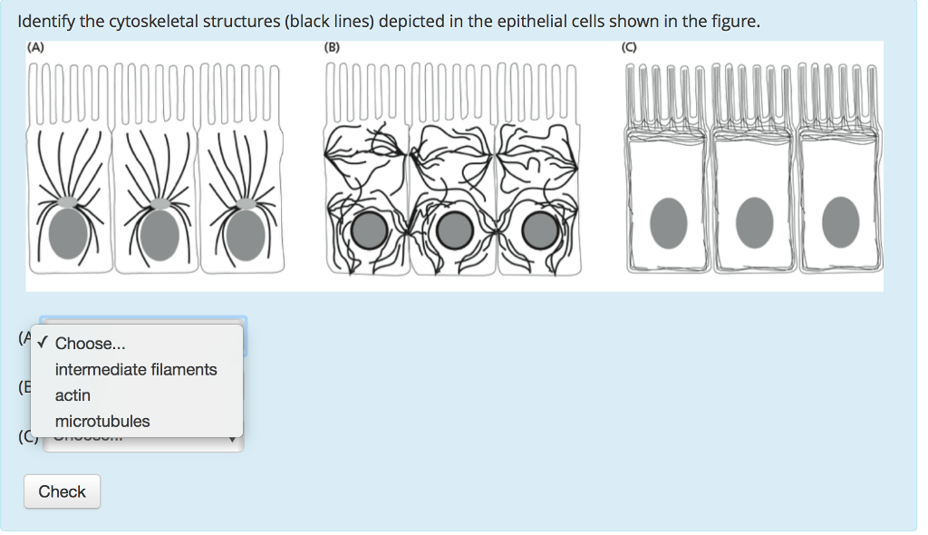 Solved Identify the cytoskeletal structures (black lines) | Chegg.com