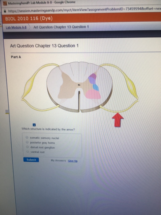 Solved Which structure is indicated by the arrow? somatic