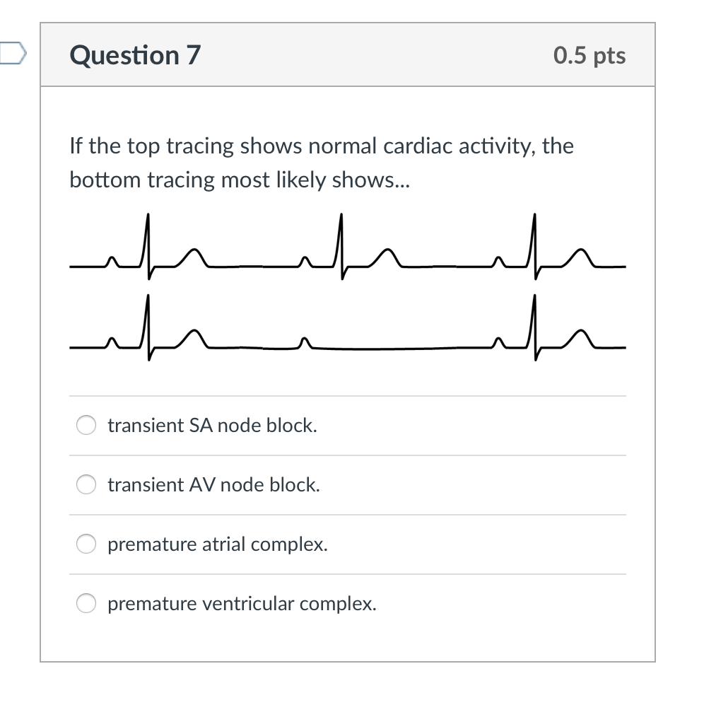 Top Tracing Solved Question 7 0.5 pts f the top tracing shows normal | Chegg.com