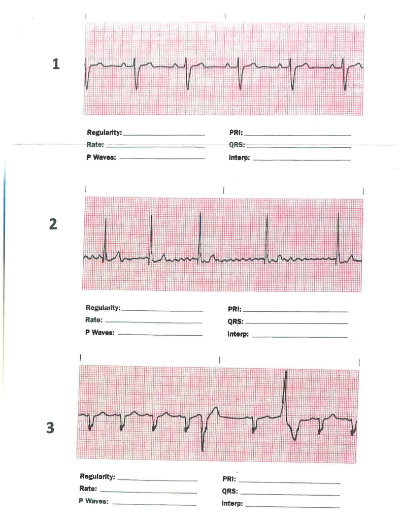 The regularity, heart rate, P wave interval length, | Chegg.com