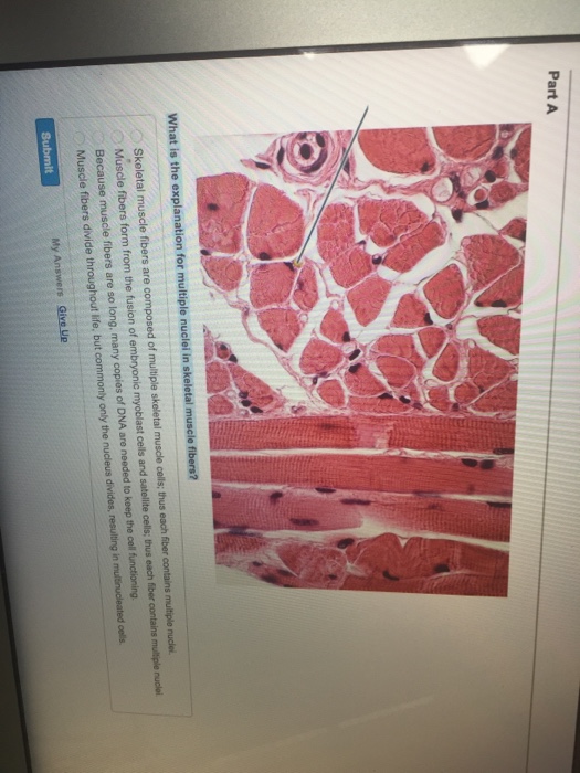 Solved What is the explanation for multiple nuclei in | Chegg.com