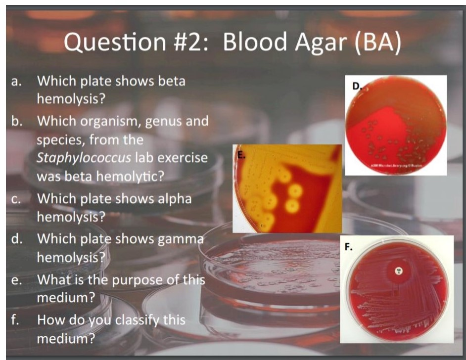 Alpha Hemolytic Staph