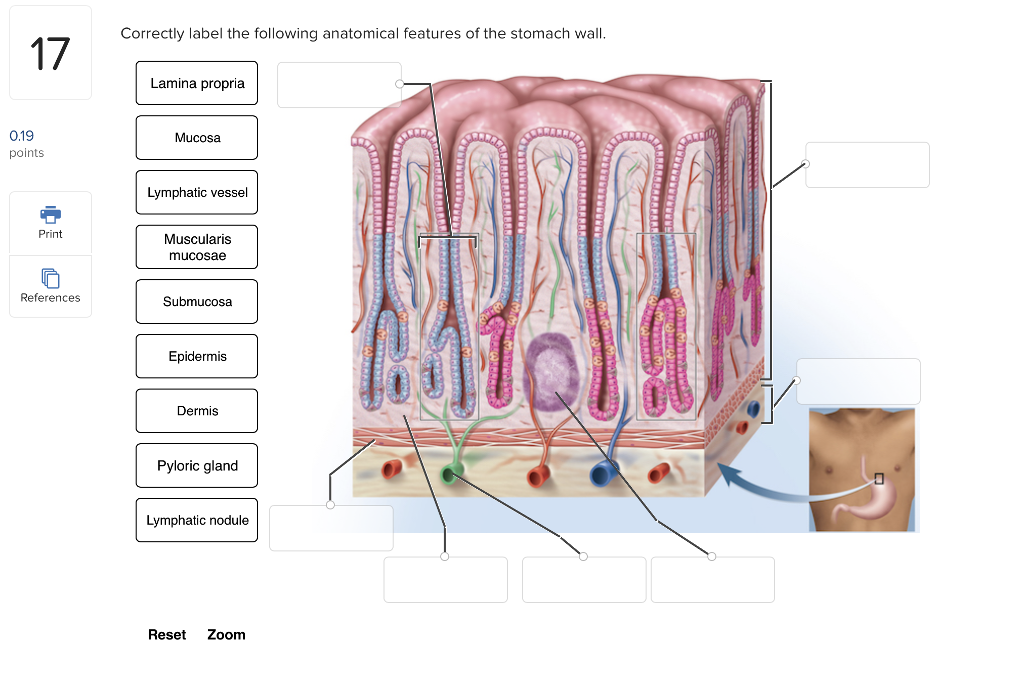 solved-correctly-label-the-following-anatomical-features-of-chegg