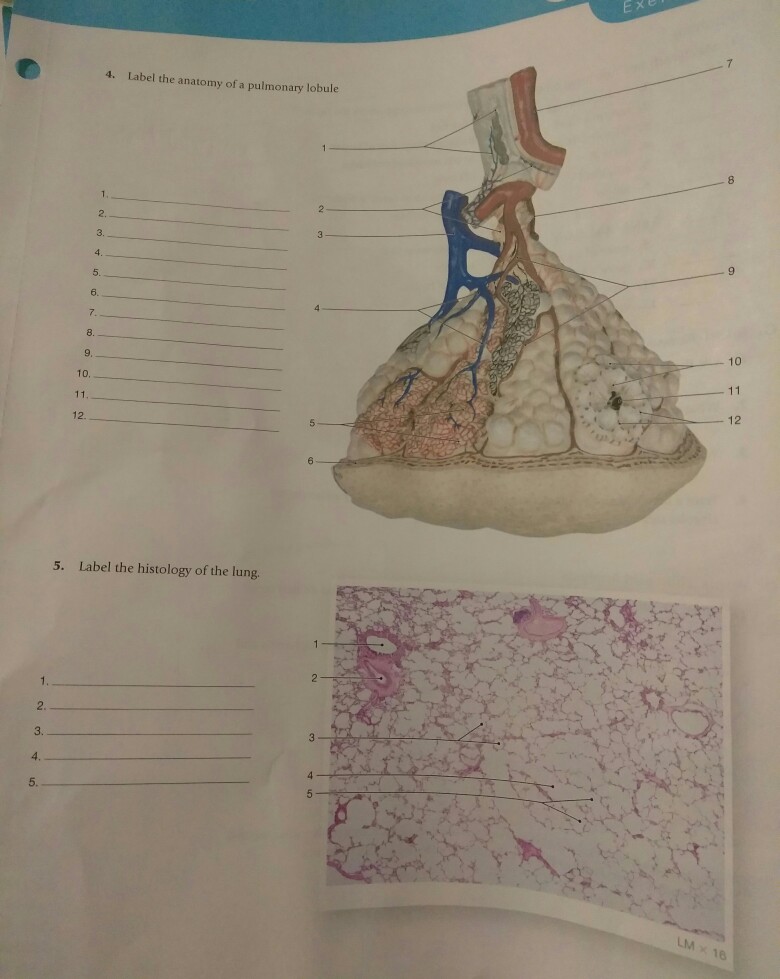 Solved 4. Label the anatomy of a pulmonary lobule 8 2. 3. 8. | Chegg.com