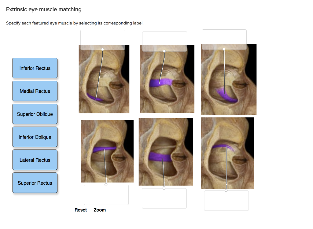 solved-extrinsic-eye-muscle-matching-specify-each-feature-chegg