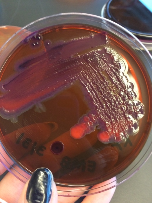 Solved Microbiology EMB question.I did a streak plate on an | Chegg.com