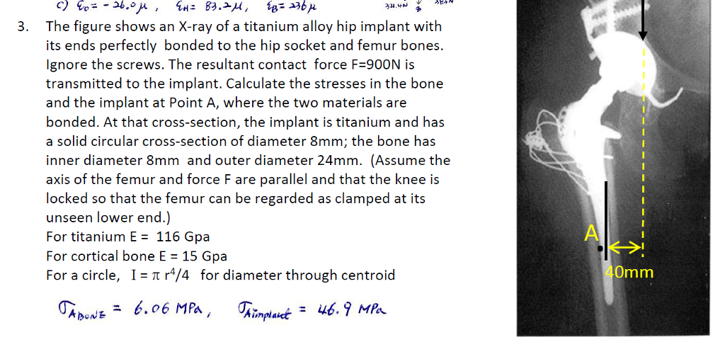 solved-the-figure-shows-an-x-ray-of-a-titanium-alloy-hip-chegg