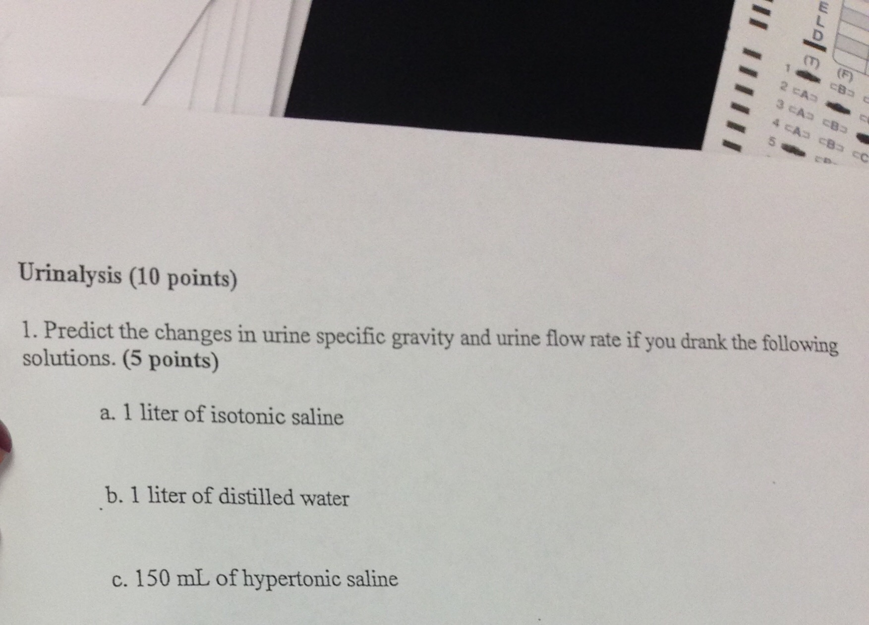 What Disease Causes Decreased Urine Specific Gravity