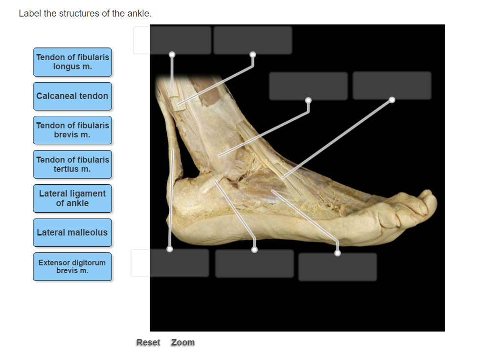 Solved Label The Structures Of The Ankle. 