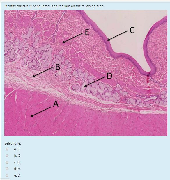 Solved Identify the stratified squamous epithelium on the | Chegg.com ...